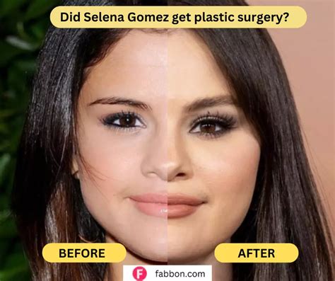 selena gomez nose|Selena Gomez Reacts to Plastic Surgery。